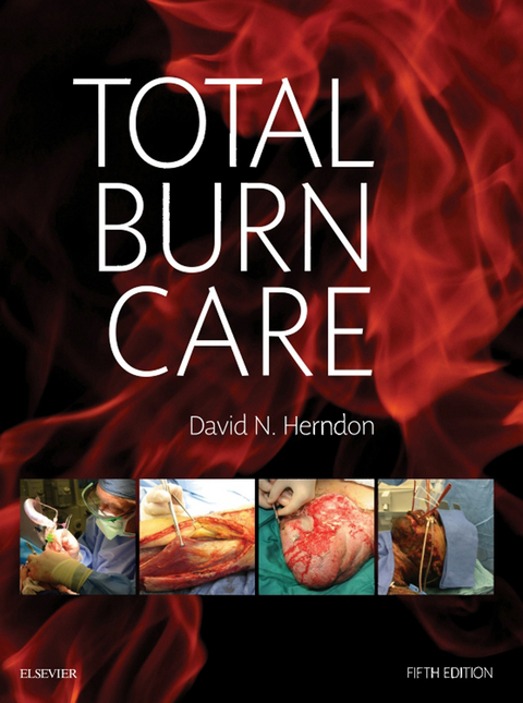 Total Burn Care -  David N. Herndon