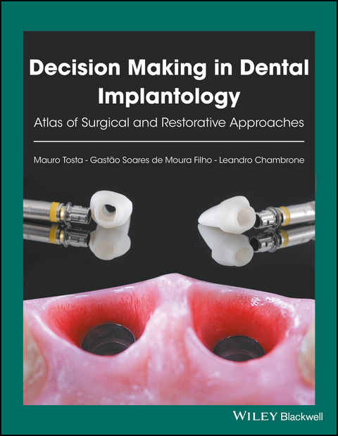Decision Making in Dental Implantology -  Leandro Chambrone,  Gast o Soares de Moura Filho,  Mauro Tosta