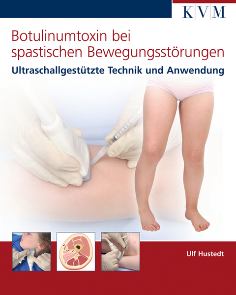 Botulinumtoxin bei spastischen Bewegungsst&ouml;rungen - Ulf Hustedt