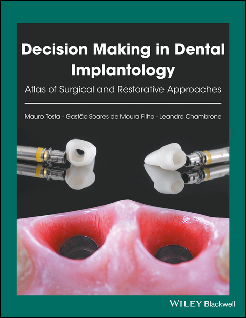 Decision Making in Dental Implantology - Mauro Tosta, Gast&atilde;o Soares de Moura Filho, Leandro Chambrone