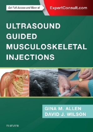 Ultrasound Guided Musculoskeletal Injections E-Book