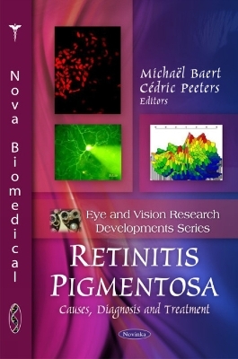 Retinitis Pigmentosa - 