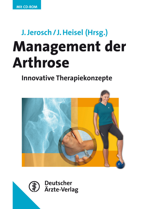 Management der Arthrose - 