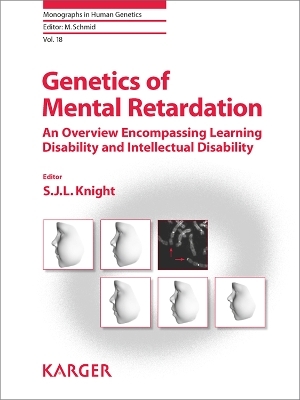 Genetics of Mental Retardation - 