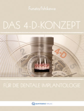 Das 4-D-Konzept f&uuml;r die dentale Implantologie - Tomohiro Ishikawa, Akiyoshi Funato