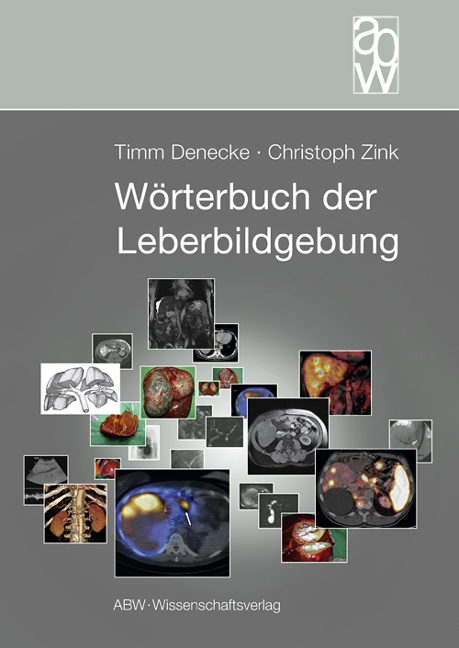 Wörterbuch der Leberbildgebung - Timm Denecke, Christoph Zink