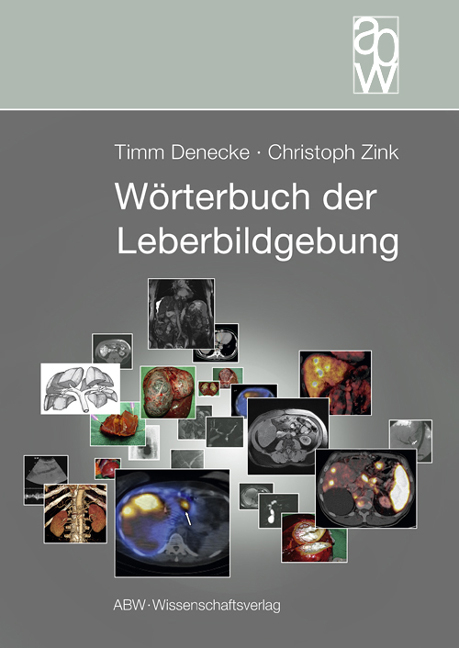 W&ouml;rterbuch der Leberbildgebung - Timm Denecke, Christoph Zink