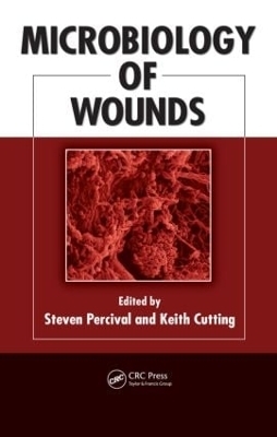 Microbiology of Wounds - 