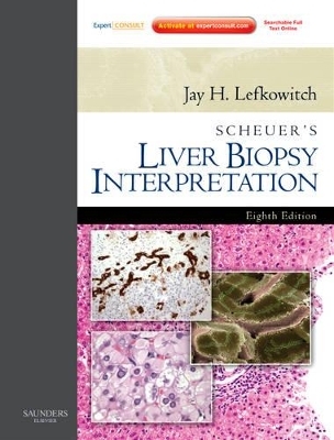 Scheuer's Liver Biopsy Interpretation - Jay H. Lefkowitch