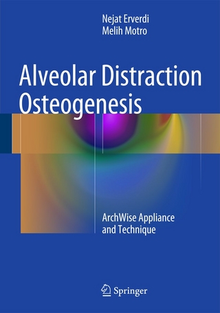 Alveolar Distraction Osteogenesis