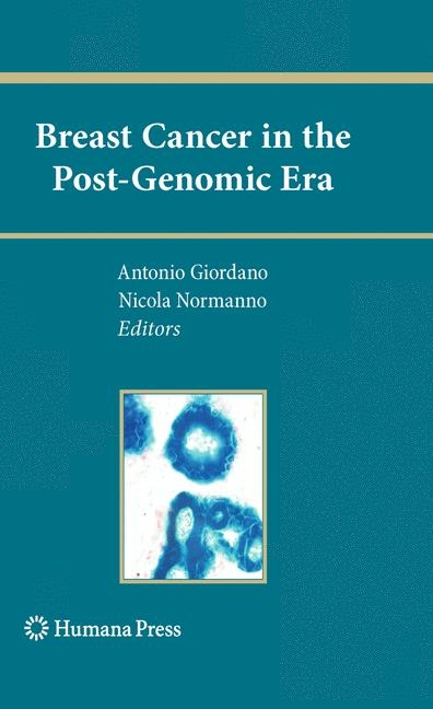 Breast Cancer in the Post-Genomic Era - 