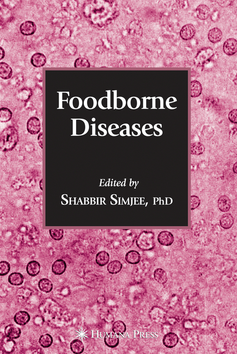 Foodborne Diseases - 