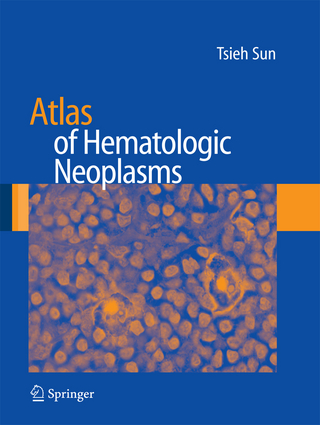 Atlas of Hematologic Neoplasms