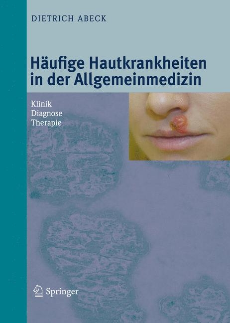 H&auml;ufige Hautkrankheiten in der Allgemeinmedizin - Dietrich Abeck