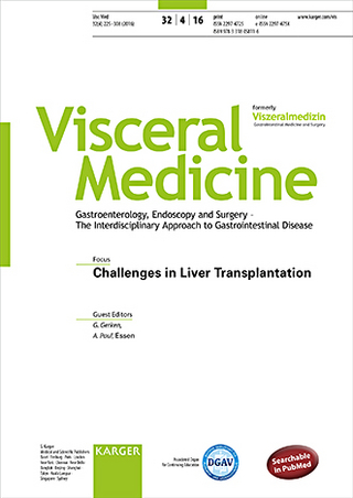 Challenges in Liver Transplantation