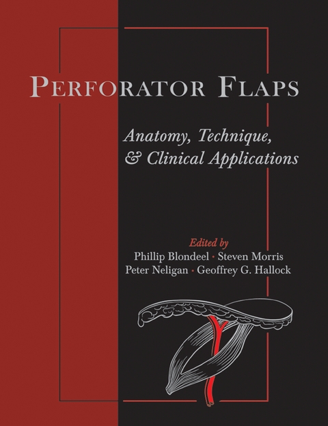 Perforator Flaps - 