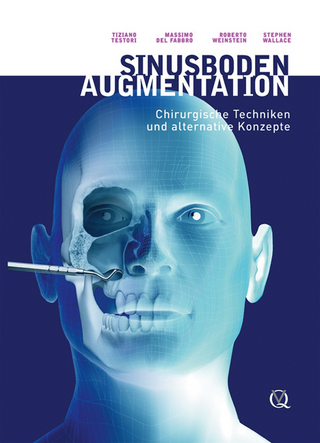 Sinusbodenaugmentation