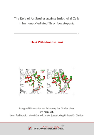 The Role of Antibodies against Endothelial Cells in Immune Mediated Thrombocytopenia