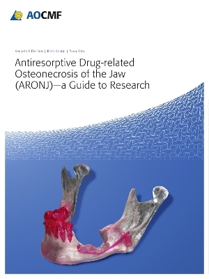 Antiresorptive Drug-Related Osteonecrosis of the Jaw (ARONJ) - A Guide to Research