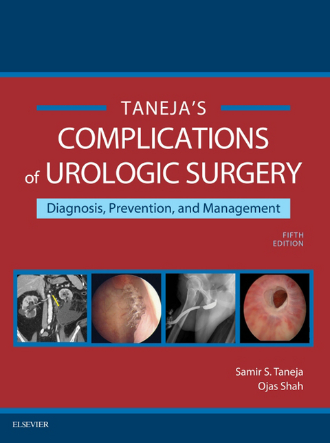 Complications of Urologic Surgery E-Book -  Ojas Shah,  Samir S. Taneja