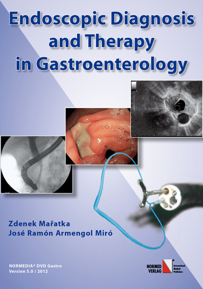 Endoscopic Diagnosis and Therapy in Gastroenterology - Zdenek Maratka, José R Armengol Miró