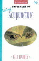 Simple Guide to Using Acupuncture