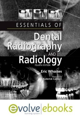 Essentials of Dental Radiography and Radiology