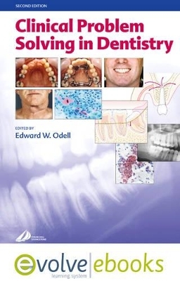 Clinical Problem Solving in Dentistry