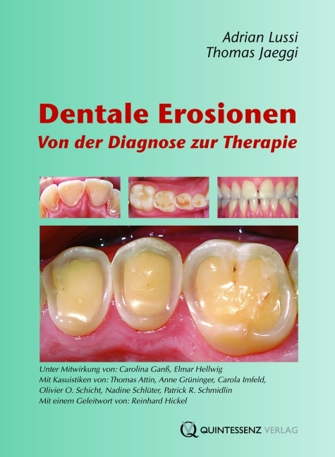 Dentale Erosionen - Adrian Lussi, Thomas Jaeggi