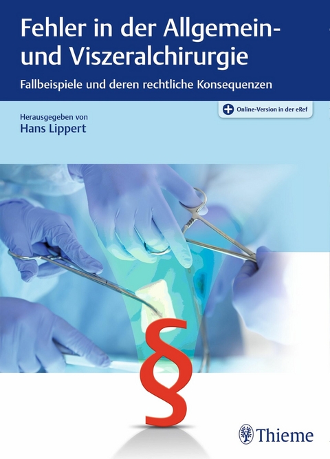 Fehler in der Allgemein- und Viszeralchirurgie - 