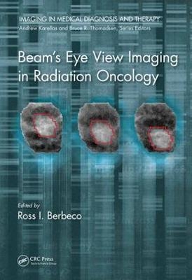 Beam's Eye View Imaging in Radiation Oncology - 