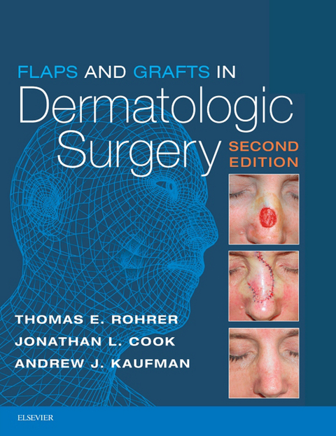 Flaps and Grafts in Dermatologic Surgery E-Book -  Jonathan L. Cook,  Andrew Kaufman,  Thomas E. Rohrer