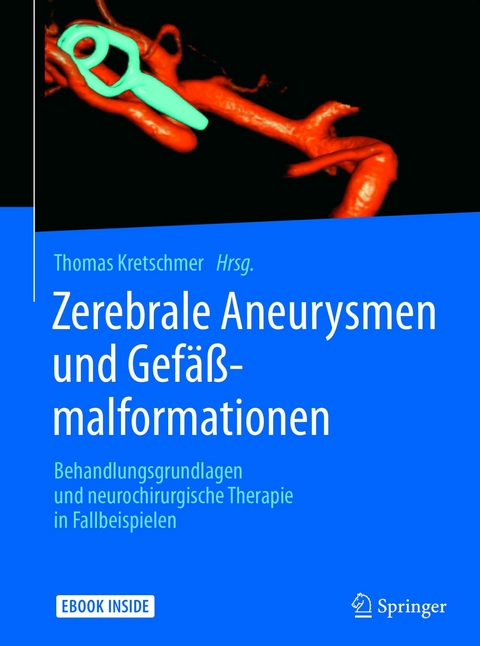 Zerebrale Aneurysmen und Gef&auml;&szlig;malformationen - 