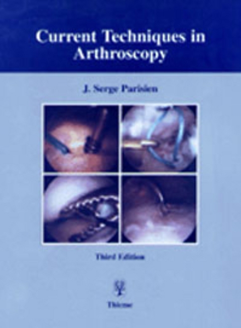 Current Techniques in Arthroscopy - 