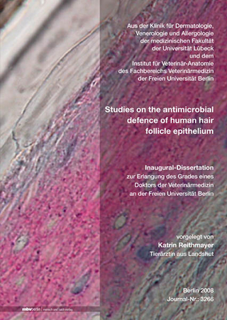 Studies on the antimicrobial defence of human hair follicle epithelium
