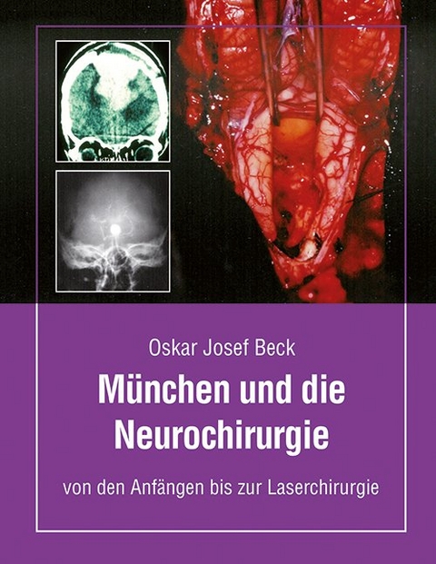 M&uuml;nchen und die Neurochirurige - Oskar Beck