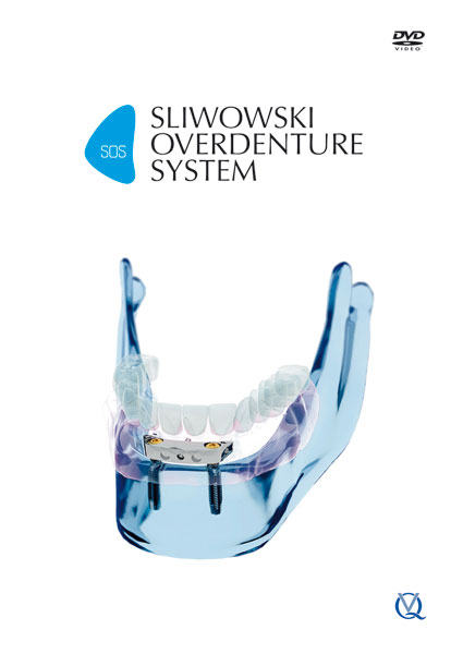 SOS &ndash; Sliwowski Overdenture System - Christoph T. Sliwowski
