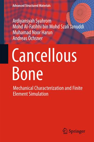 Cancellous Bone