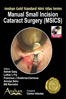 Mini Atlas of Manual Small Incision Cataract Surgery - 