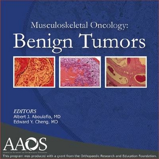 Musculoskeletal Oncology