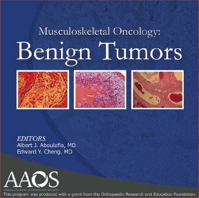 Musculoskeletal Oncology - 