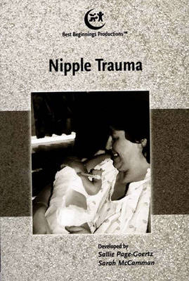 Breastfeeding Management Series: Nipple Trauma