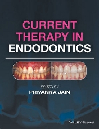 Current Therapy in Endodontics