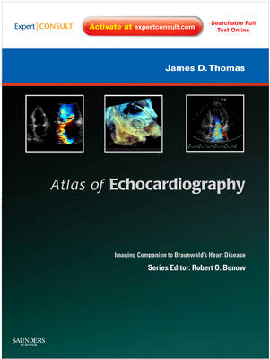 Atlas of Echocardiography