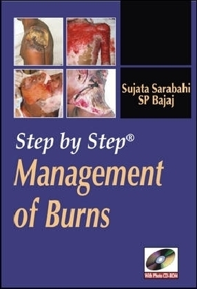 Step by Step Management of Burns - Sujata Sarabahi, S.P. Bajaj