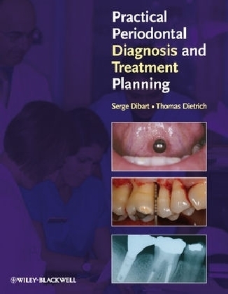 Practical Periodontal Diagnosis and Treatment Planning - Serge Dibart