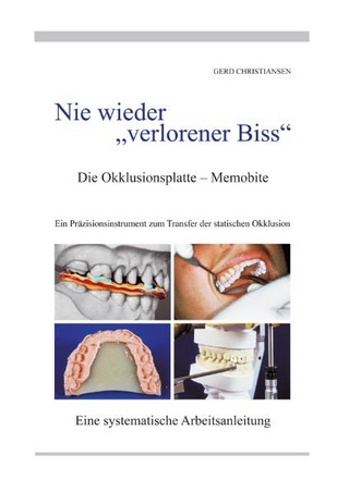 Nie wieder verlorener Biss