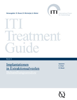 Implantationen in Extraktionsalveolen - 