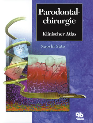 Parodontalchirurgie