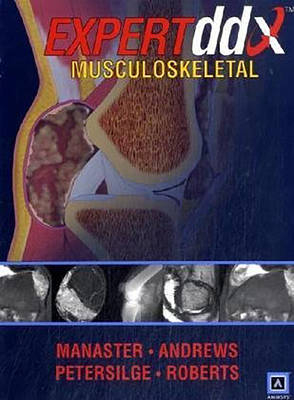 EXPERTddx : Musculoskeletal - B. J. Manaster, Catherine C. Roberts, Carol L. Andrews, Cheryl A. Petersilge